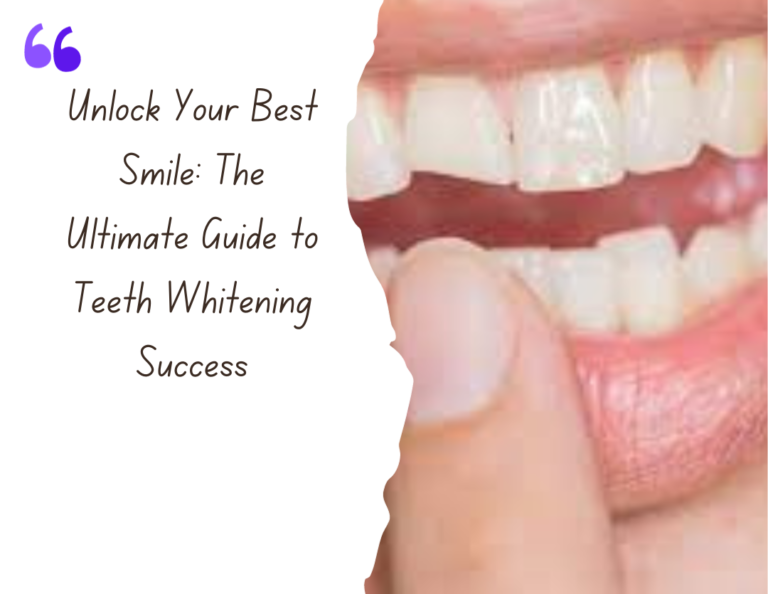 Smile Makeover: Transforming Your Appearance with Professional Teeth Whitening