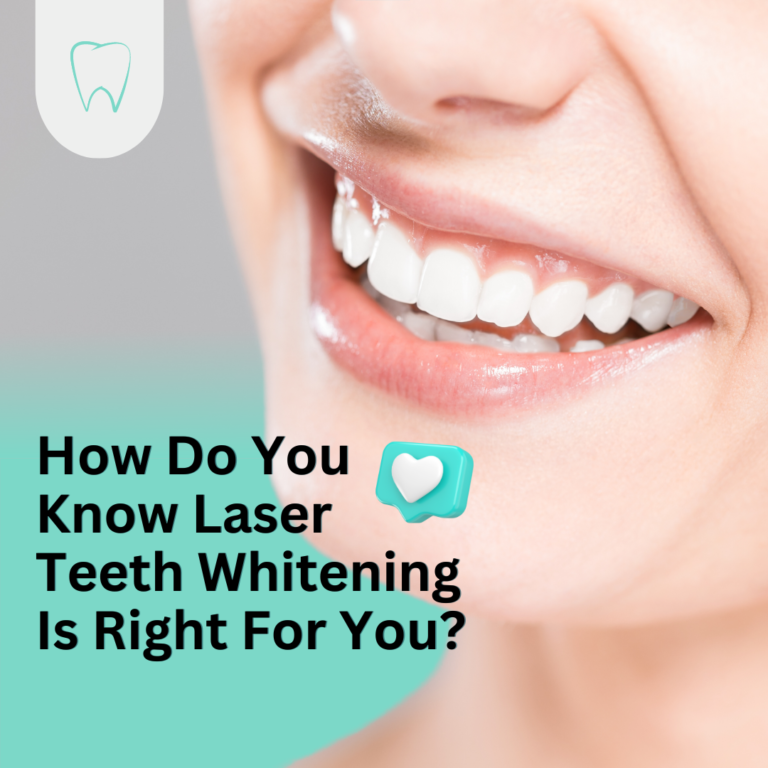 How Do You Know Laser Teeth Whitening Is Right For You?