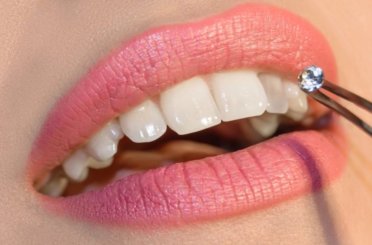 tooth gems carousel image